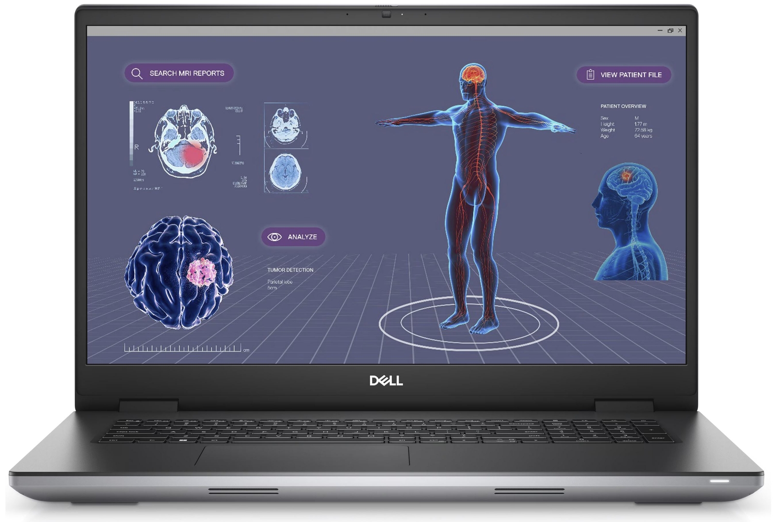 Dell Precision 7770 17.3 FHD✓i9-12950HX✓16GB RAM✓512GB SSD✓RTX A3000 12GB✓WARNTY
